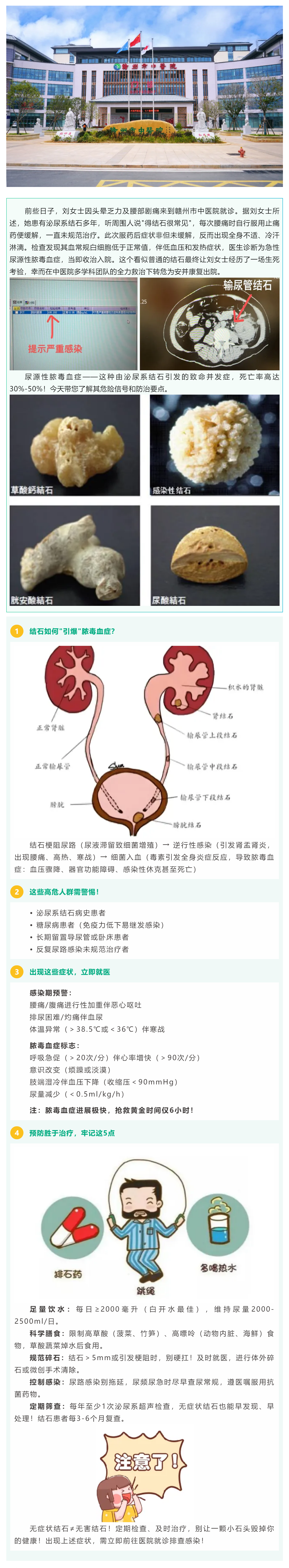 沉默的結(jié)石，暗藏的_致命危機_——警惕尿源性膿毒血癥！.png