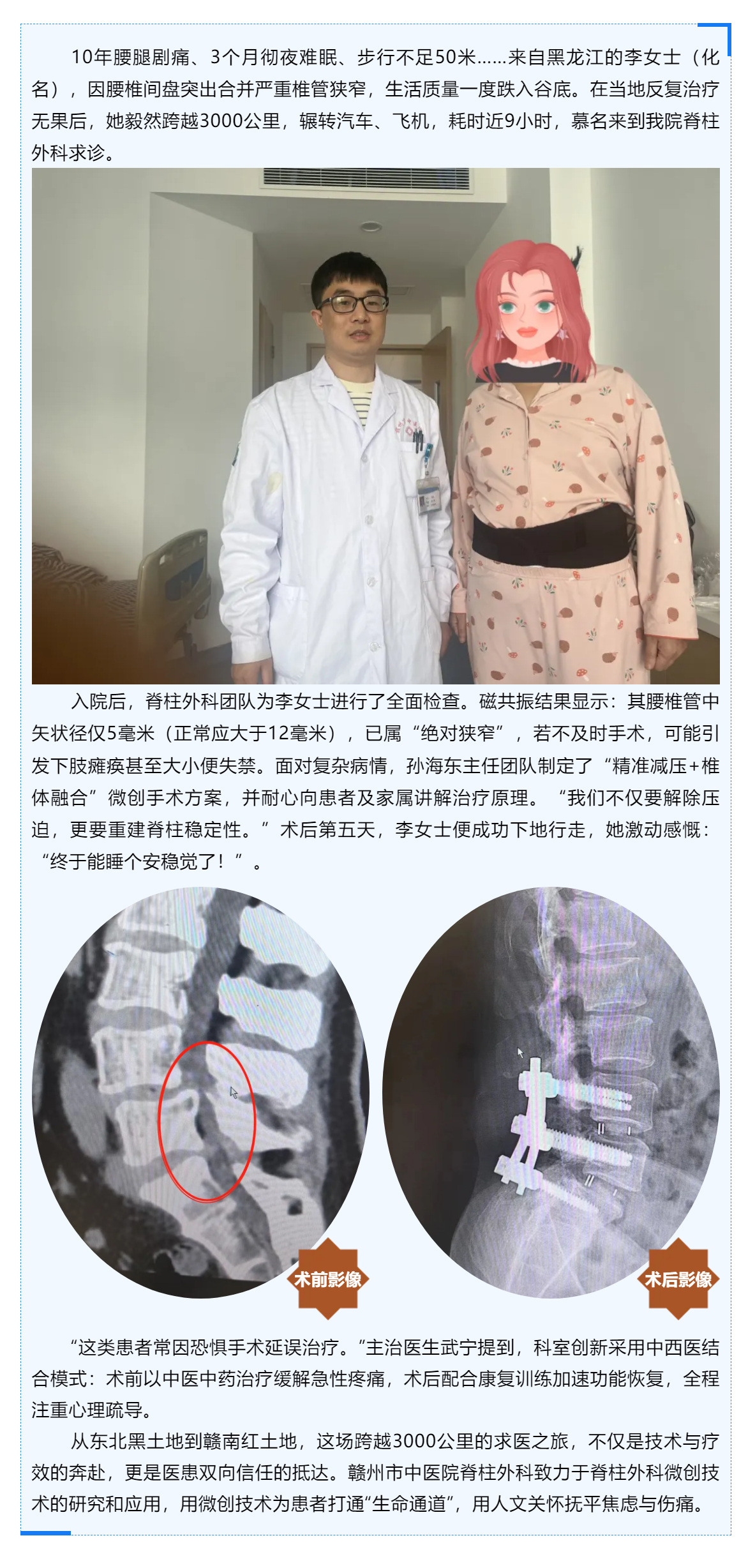 跨越山河的信任_贛州市中醫(yī)院巧手“疏堵”，腰椎狹窄患者3000公里求醫(yī)路終迎新生！.png